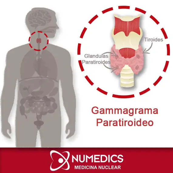 Gammagrafía Paratiroidea